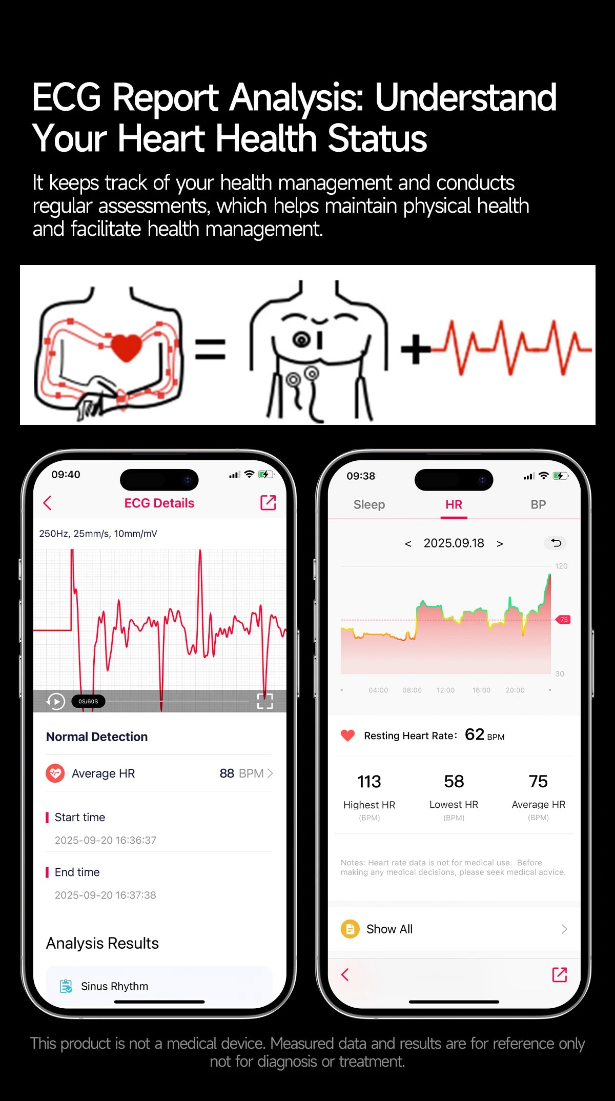 2025New Micro Physical Examination Smart Watch For Men Uric Acid Body Fat Five Organ Health Watches Bluetooth Call SmartBracelet